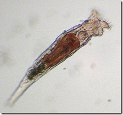 bdelloid rotifer (possibly Philodina acuticornis)