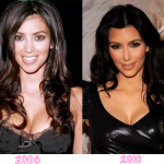 kim-k-before-and-after