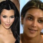 kimkardashianbotox350
