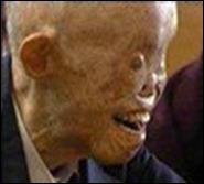 sobreviviente de hiroshima