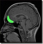 orbitofrontala cortex