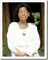 FAKHRA-