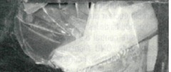 MALETA COCA
