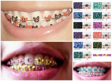 Deadly Fashion Braces))