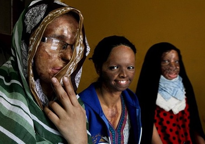 Stop Acid Attacks  New Delhi, India